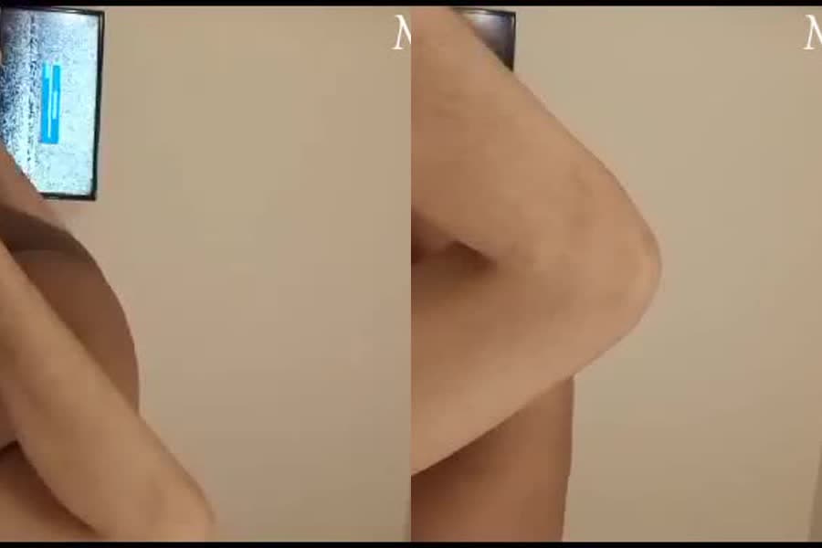 Thumnail